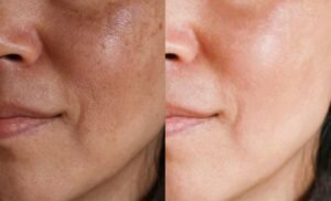 A luxurious skin tone enhancer enriched with glutathione serum, saffron threads, clove oil, and flax seed oil to target dark spots, pigmentation, and uneven skin tone.